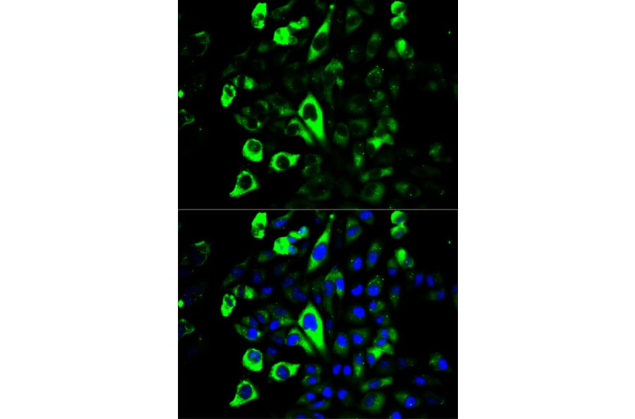 Immunofluorescence - GZMB Antibody from Signalway Antibody (32711) - Antibodies.com