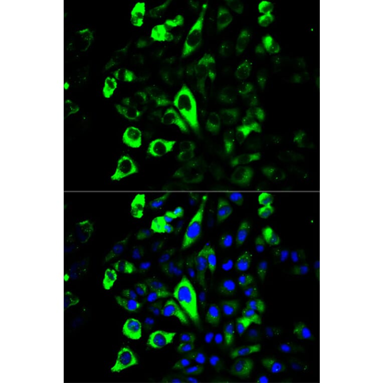Immunofluorescence - GZMB Antibody from Signalway Antibody (32711) - Antibodies.com