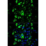 Immunofluorescence - GZMB Antibody from Signalway Antibody (32711) - Antibodies.com