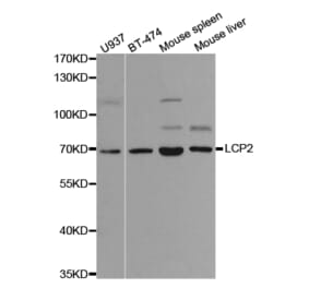 Western blot - LCP2 Antibody from Signalway Antibody (32719) - Antibodies.com