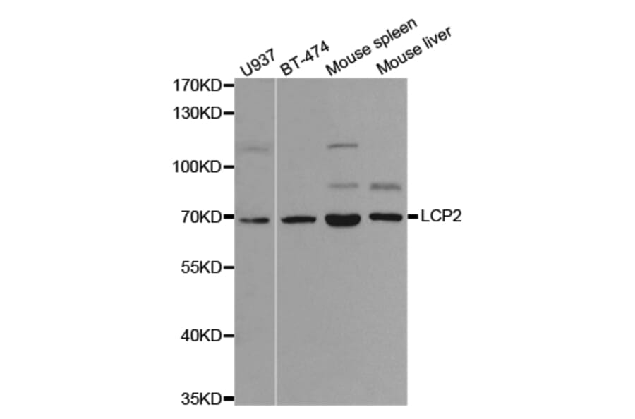Western blot - LCP2 Antibody from Signalway Antibody (32719) - Antibodies.com