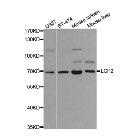 Western blot - LCP2 Antibody from Signalway Antibody (32719) - Antibodies.com