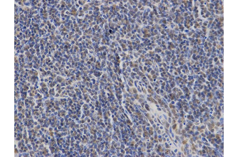 Immunohistochemistry - LCP2 Antibody from Signalway Antibody (32719) - Antibodies.com