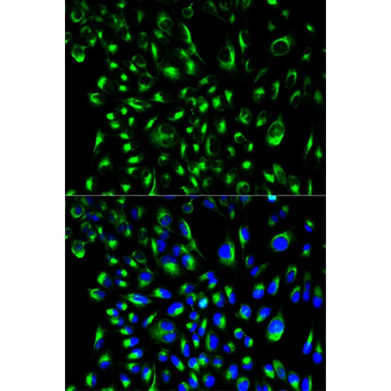 Immunofluorescence - LCP2 Antibody from Signalway Antibody (32719) - Antibodies.com