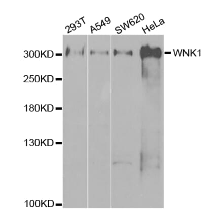 Western blot - WNK1 Antibody from Signalway Antibody (32721) - Antibodies.com