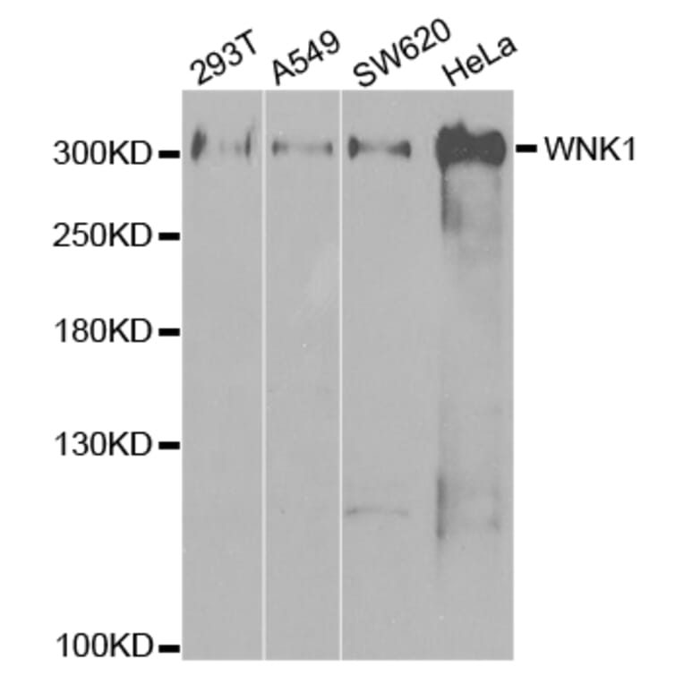 Western blot - WNK1 Antibody from Signalway Antibody (32721) - Antibodies.com