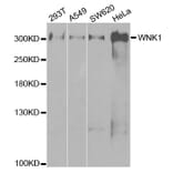 Western blot - WNK1 Antibody from Signalway Antibody (32721) - Antibodies.com