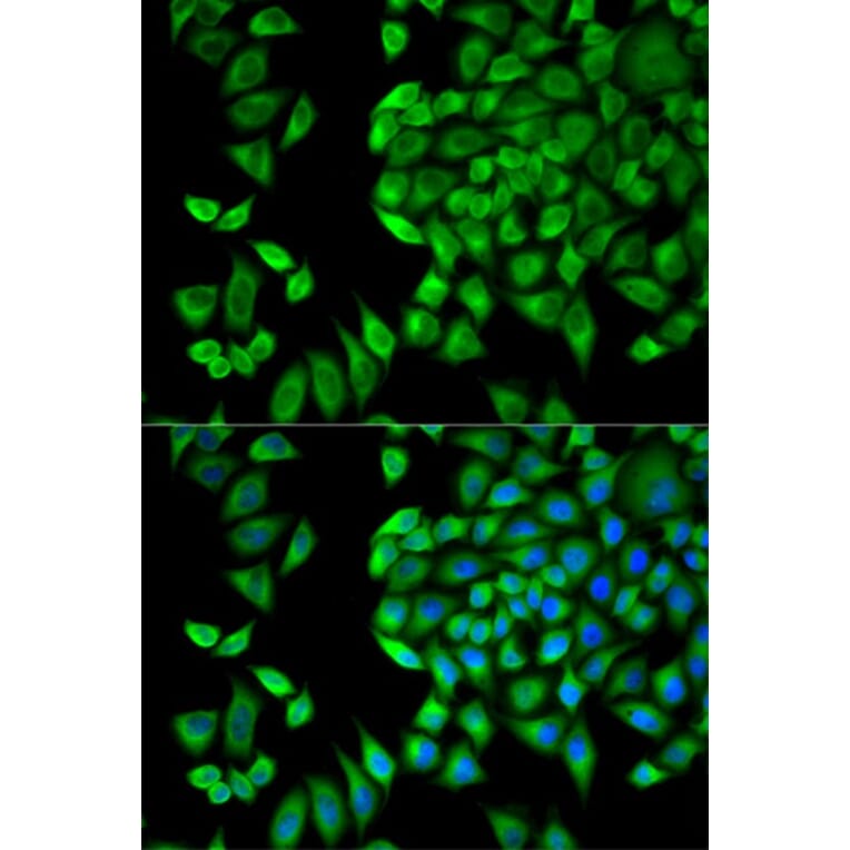 Immunofluorescence - WNK1 Antibody from Signalway Antibody (32721) - Antibodies.com