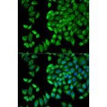 Immunofluorescence - WNK1 Antibody from Signalway Antibody (32721) - Antibodies.com