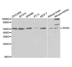 Western blot - WASL Antibody from Signalway Antibody (32726) - Antibodies.com