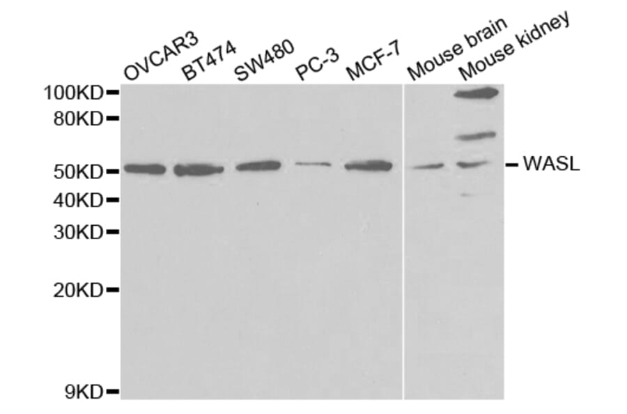 Western blot - WASL Antibody from Signalway Antibody (32726) - Antibodies.com