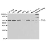 Western blot - WASL Antibody from Signalway Antibody (32726) - Antibodies.com
