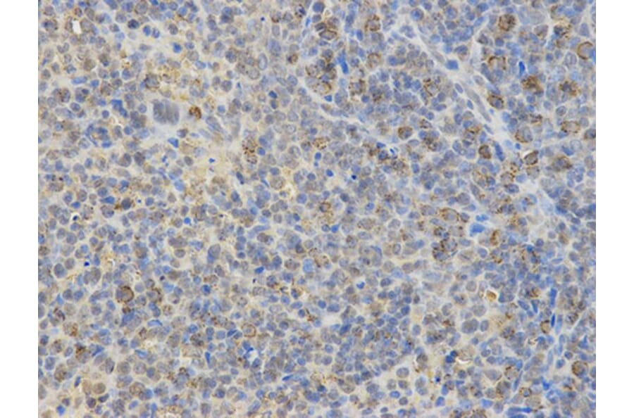 Immunohistochemistry - WASL Antibody from Signalway Antibody (32726) - Antibodies.com