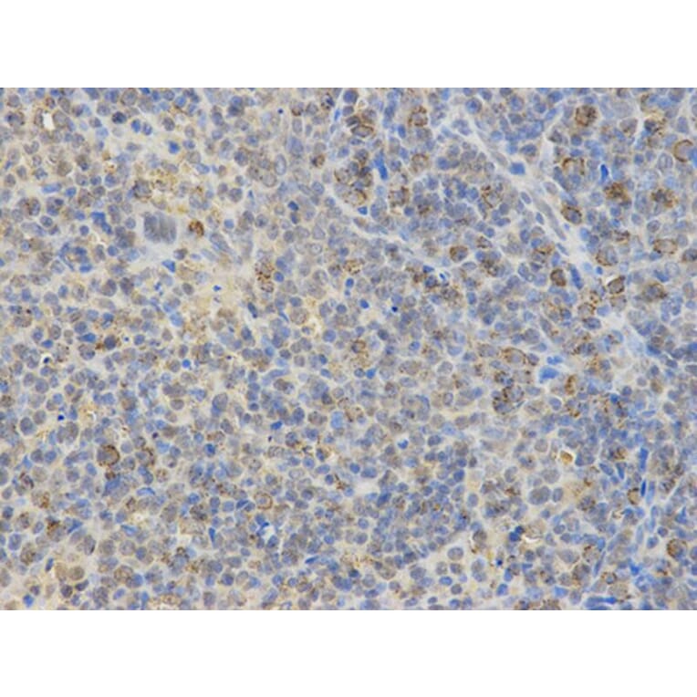 Immunohistochemistry - WASL Antibody from Signalway Antibody (32726) - Antibodies.com