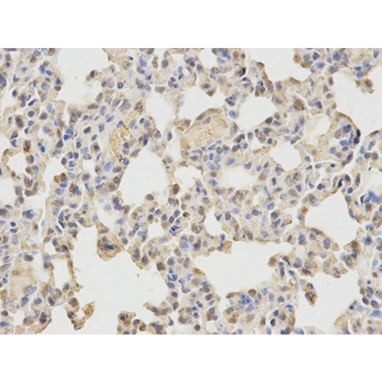 Immunohistochemistry - WASL Antibody from Signalway Antibody (32726) - Antibodies.com