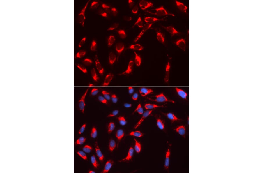 Immunofluorescence - WASL Antibody from Signalway Antibody (32726) - Antibodies.com