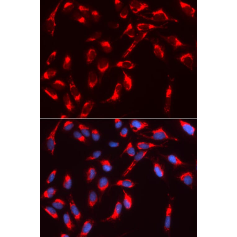 Immunofluorescence - WASL Antibody from Signalway Antibody (32726) - Antibodies.com