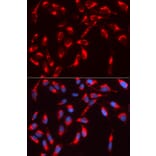 Immunofluorescence - WASL Antibody from Signalway Antibody (32726) - Antibodies.com