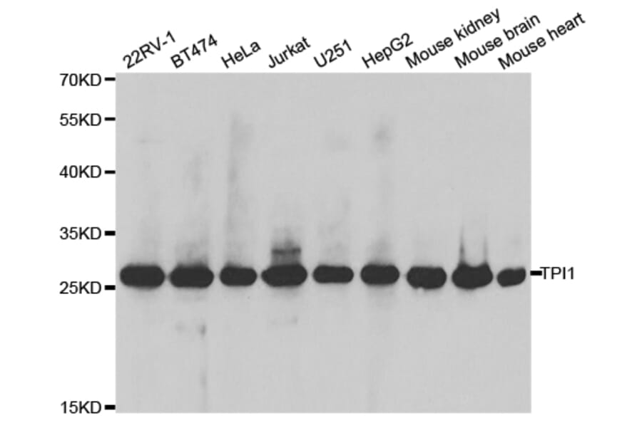 Western blot - TPI1 Antibody from Signalway Antibody (32729) - Antibodies.com