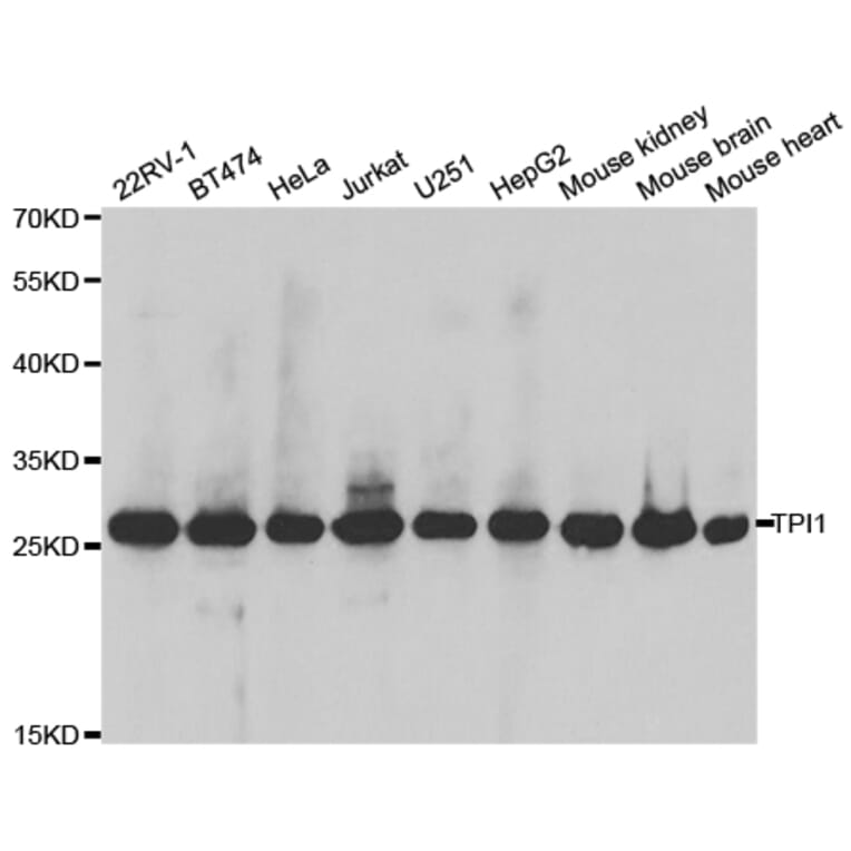 Western blot - TPI1 Antibody from Signalway Antibody (32729) - Antibodies.com