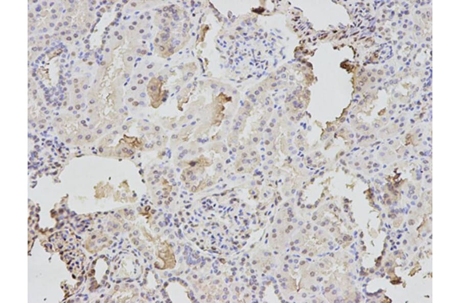 Immunohistochemistry - TPI1 Antibody from Signalway Antibody (32729) - Antibodies.com
