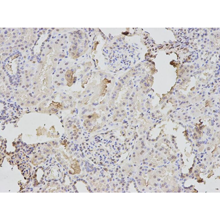 Immunohistochemistry - TPI1 Antibody from Signalway Antibody (32729) - Antibodies.com