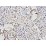 Immunohistochemistry - TPI1 Antibody from Signalway Antibody (32729) - Antibodies.com