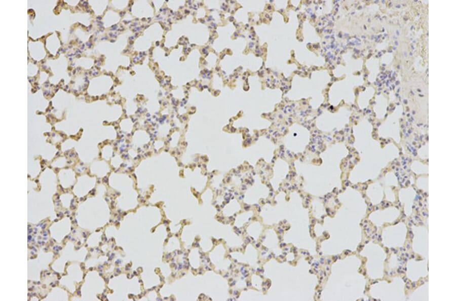 Immunohistochemistry - TPI1 Antibody from Signalway Antibody (32729) - Antibodies.com