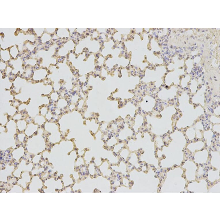 Immunohistochemistry - TPI1 Antibody from Signalway Antibody (32729) - Antibodies.com