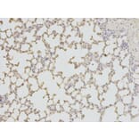 Immunohistochemistry - TPI1 Antibody from Signalway Antibody (32729) - Antibodies.com