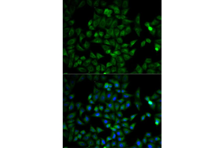 Immunofluorescence - TPI1 Antibody from Signalway Antibody (32729) - Antibodies.com