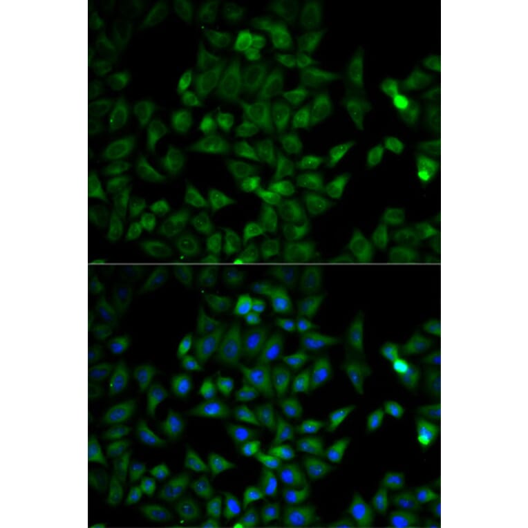 Immunofluorescence - TPI1 Antibody from Signalway Antibody (32729) - Antibodies.com