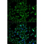 Immunofluorescence - TPI1 Antibody from Signalway Antibody (32729) - Antibodies.com