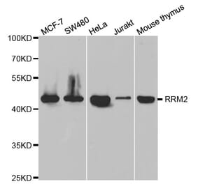 Western blot - RRM2 Antibody from Signalway Antibody (32745) - Antibodies.com