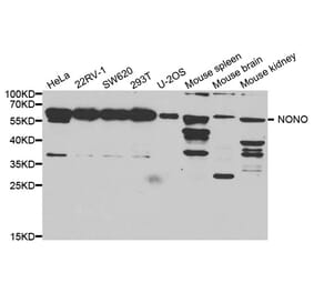 Western blot - Nono Antibody from Signalway Antibody (32746) - Antibodies.com