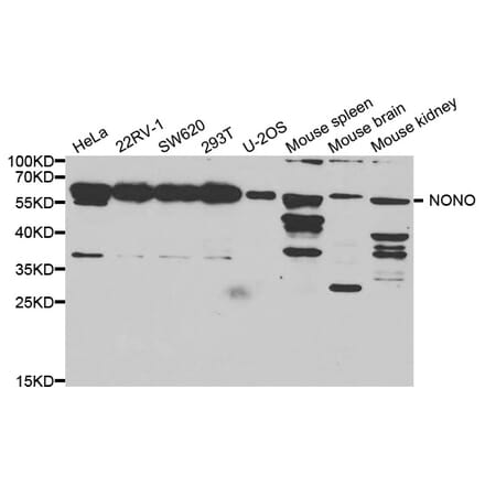 Western blot - Nono Antibody from Signalway Antibody (32746) - Antibodies.com