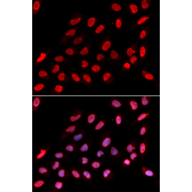 Immunofluorescence - Nono Antibody from Signalway Antibody (32746) - Antibodies.com
