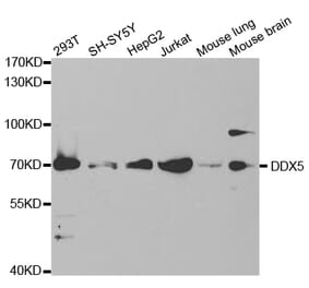 Western blot - DDX5 Antibody from Signalway Antibody (32750) - Antibodies.com