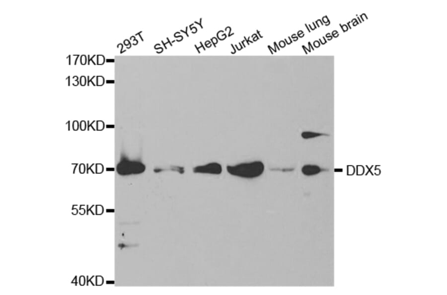 Western blot - DDX5 Antibody from Signalway Antibody (32750) - Antibodies.com