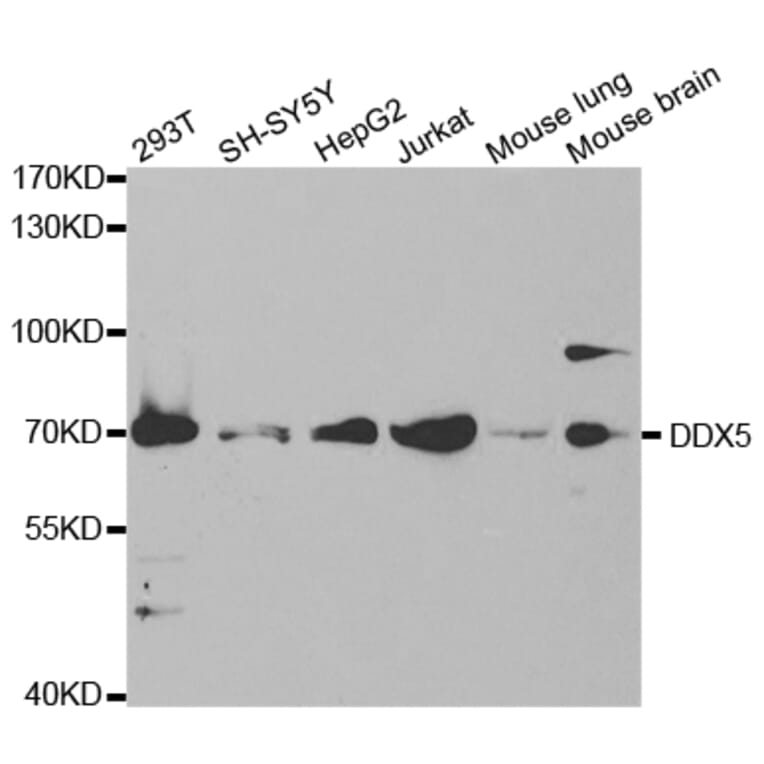 Western blot - DDX5 Antibody from Signalway Antibody (32750) - Antibodies.com