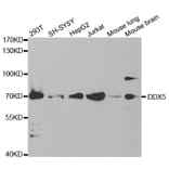 Western blot - DDX5 Antibody from Signalway Antibody (32750) - Antibodies.com