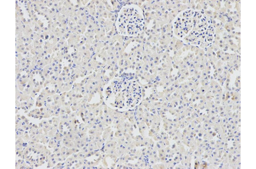 Immunohistochemistry - DDX5 Antibody from Signalway Antibody (32750) - Antibodies.com