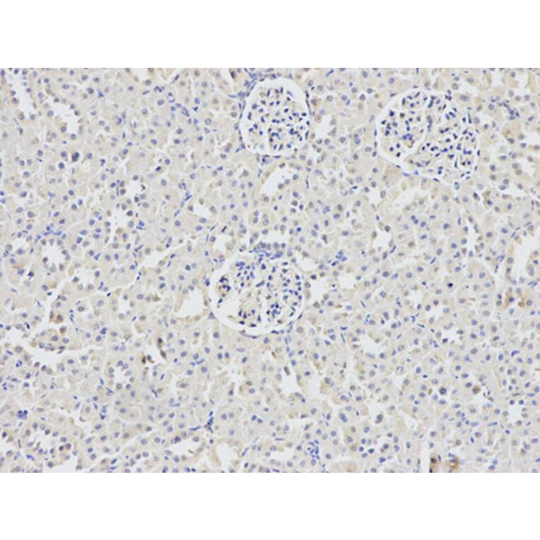 Immunohistochemistry - DDX5 Antibody from Signalway Antibody (32750) - Antibodies.com