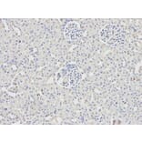 Immunohistochemistry - DDX5 Antibody from Signalway Antibody (32750) - Antibodies.com