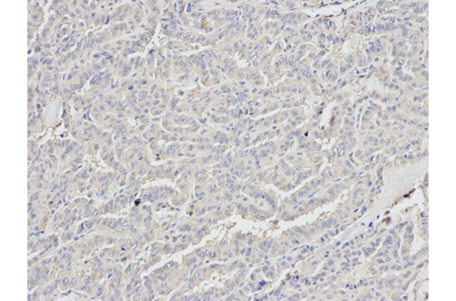 Immunohistochemistry - DDX5 Antibody from Signalway Antibody (32750) - Antibodies.com