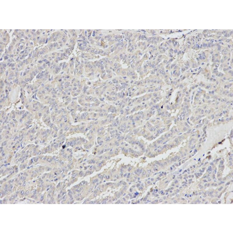 Immunohistochemistry - DDX5 Antibody from Signalway Antibody (32750) - Antibodies.com