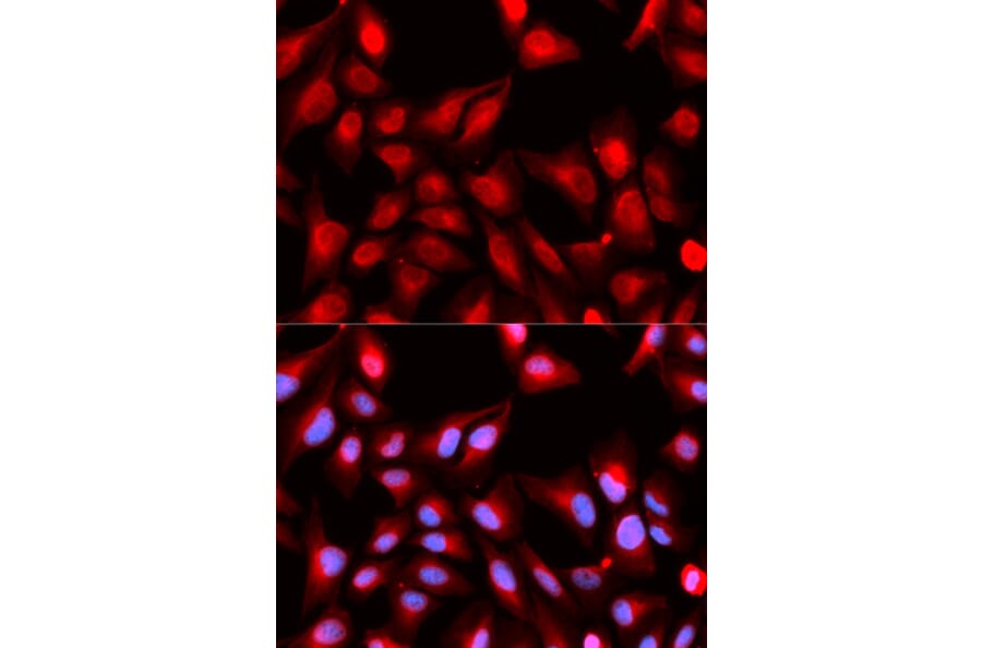 Immunofluorescence - DDX5 Antibody from Signalway Antibody (32750) - Antibodies.com