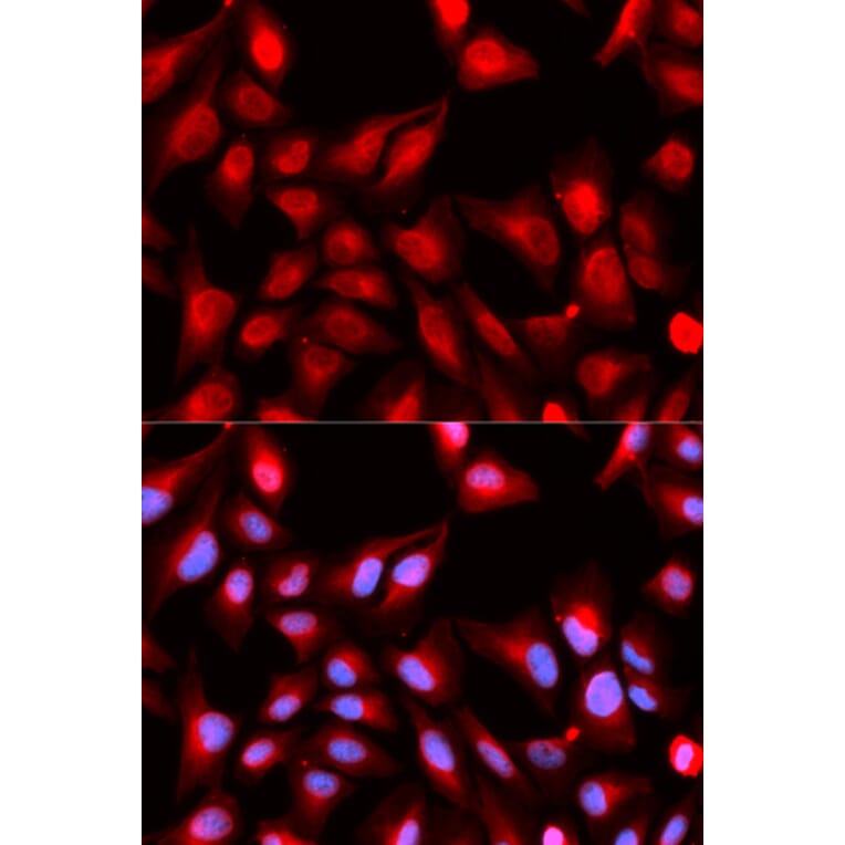 Immunofluorescence - DDX5 Antibody from Signalway Antibody (32750) - Antibodies.com