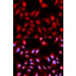 Immunofluorescence - DDX5 Antibody from Signalway Antibody (32750) - Antibodies.com