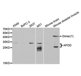 Western blot - APOD Antibody from Signalway Antibody (32751) - Antibodies.com